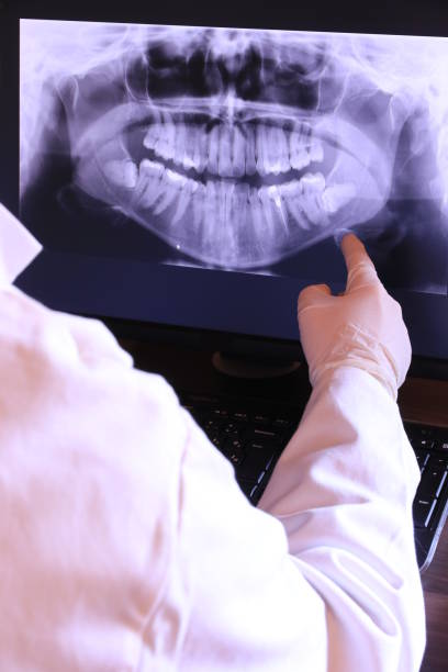 Best Emergency Tooth Extraction in East Falmouth, MA